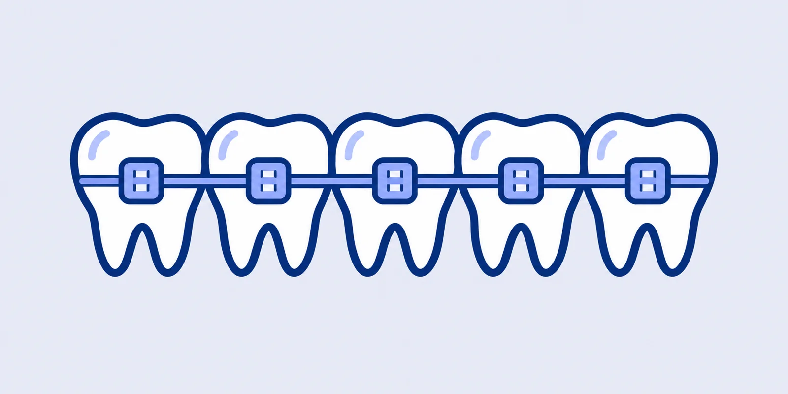 A row of teeth with braces